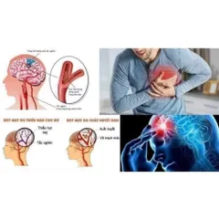 VIÊN UỐNG HỖ TRỢ TIM MẠCH QUNOL ULTRA COQ10 100MG MỸ – HẤP THU GẤP 3 LẦN
