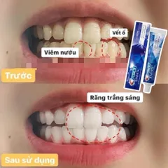 Tách lẻ 1 tuýp kem đánh răng crest 3d white advanced whitening tuýp 147g crest Mỹ