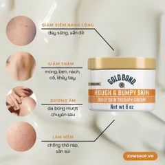 Kem Dưỡng Ẩm Sâu Cho Da Khô Sần Gold Bond Rough & Bumpy Skin 226g Mỹ