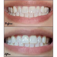 Lốc 5 TUÝP Kem Đánh Răng Crest 3D White Vivid Mint Ultra 158g - Ceria Cosmetics Store DATE 2025