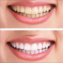 Lốc 5 Kem đánh răng Colgate Total Advanced Whitening của Mỹ