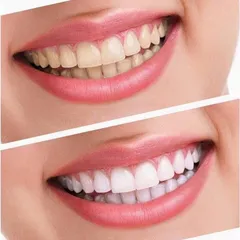 1 tuýp kem đánh răng crest 3d white advanced whitening tuýp 147g crest Mỹ