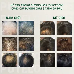 Dầu Xả – Ủ hỗ trợ giảm rụng tóc, cấp ẩm, chăm sóc 3 tầng da đầu PUTELO Hair Scalp Pack từ NHẬT 240g
