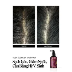 [BEBU] Nước Dưỡng Da Đầu Bồ Kết Cocoon 50ml Giảm Gàu Chăm Sóc Da Đầu Nhạy Cảm