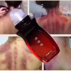 Dầu cạo gió đả thông kinh lạc CỔN CỔN THÔNG. Cạo gió giảm đau nhức toàn thân dùng trong dưỡng sinh
