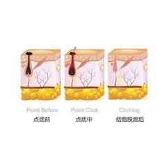 Máy Đốt Nốt Ruồi, Đốt Hôi Nách, Đốt Mụn Thịt I Máy Đốt Nốt Ruồi 9 Cấp Độ Máy Chăm Sóc Da Spa