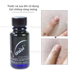 Dung dịch loại bỏ nấm móng Varisi hỗ trợ trị nấm móng nhanh chóng chuyên dụng ngành nail