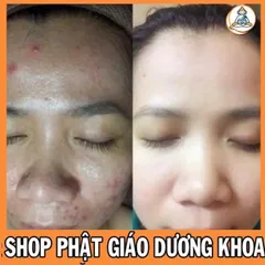 10Ml Cao lá nam sạch mụn, mờ thâm, dưỡng trắng da  DƯƠNG KHOA SHOP DƯƠNG KHOA SHOP