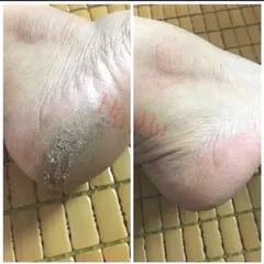 Máy chà gót chân TL-DS01 chính hãng siêu bền khoẻ chuyên dụng tẩy da chết chân tay cho tiệm Nail Spa