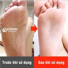 Máy chà gót chân TL-DS01 chính hãng siêu bền khoẻ chuyên dụng tẩy da chết chân tay cho tiệm Nail Spa