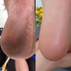 Chà gót chân inox không gỉ thay được lưỡi chuyên dụng ngành nail spa