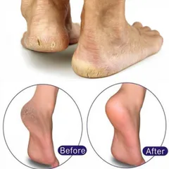 Kem mềm da vòi Sina giúp mềm da nhặt da, chà gót chân Nail & Spa chuyên dụng hàng chuẩn