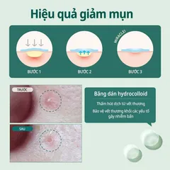 Miếng Dán Mụn Some By Mi Clear Spot Patch - Gói 18 Miếng