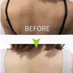 Xà phòng và xịt mụn lưng Pelican For Back Medicated White Conc Nhật Bản