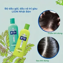 Set Gội Xả Lion Ngăn Gàu Okuto White Conc Nhật Bản Chai 320ml