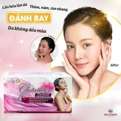 Viên Uống Trắng Da Glutathione DK500 - Giúp Da Trắng Sáng, Căng Mịn, Chống Lão Hóa Da Hộp 30 Viên