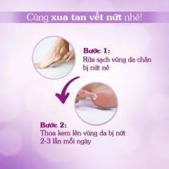 Kem nứt gót và dưỡng da chân tay Oriss tinh chất nghệ và trầu không tái tạo làm hồng gót Tuýp 30gr 847535