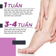 Kem nứt gót và dưỡng da chân tay Oriss tinh chất nghệ và trầu không tái tạo làm hồng gót Tuýp 30gr 847535