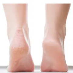 Miếng chà gót chân Thủy tinh Nano Nhật Bản giúp da chân mềm mại, hồng hào