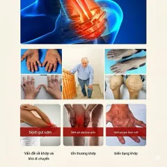Kem Xoa Bóp Bôi Ngoài Da Baian Shi Tongfengao Giúp Giảm Đau Độ Gút Và Làm Dịu Cảm Giác Sưng Đỏ