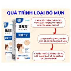 (Nhật Bản) Kem loại bỏ mụn thịt trên cổ, da thừa, mụn cóc dạng sợi, mụn nhỏ ở vùng nách, dưỡng sáng