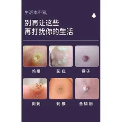 (Nhật Bản) Kem loại bỏ mụn thịt trên cổ, da thừa, mụn cóc dạng sợi, mụn nhỏ ở vùng nách, dưỡng sáng