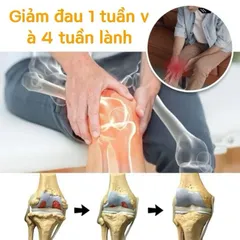 Kem Nọc Ong 20g Cao Cấp, Gel Bôi Xương Khớp Nọc Ong Giảm Đau Khớp Viêm Khớp Chính Hãng
