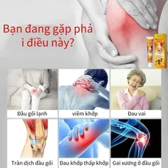 Kem Nọc Ong 20g Cao Cấp, Gel Bôi Xương Khớp Nọc Ong Giảm Đau Khớp Viêm Khớp Chính Hãng