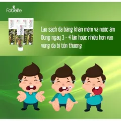 Gel Tái Tạo Anti Virus Fobe Hỗ Trợ Làm Lành Da Do Virus Gây Nên, Thủy Đậu- 15g & 30g
