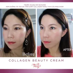 Kem Collagen MISS FAIRY - Nhau Thai Cừu 15g - Làm Trắng - Chống Nhăn - Ngừa Lão Hóa - Tái Tạ Da