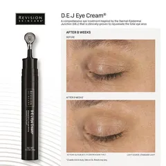 Kem Mắt Revision Skincare D.E.J Eye Cream 14g - Chống Lão Hóa, Giúp Săn Chắc Vùng Mắt, Phù Hợp Mọi Loại Da 868673