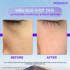 Sữa rửa mặt dạng gel Dermarium Goodnight chứa than hoạt tính làm sạch sâu dịu nhẹ, dung tích 55ml
