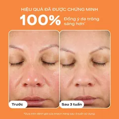 Tinh chất làm sáng da, mờ thâm nám và giảm nếp nhăn chứa 15% Vitamin Paula's choice C15 Super Booster-chính hãng nhập khẩu