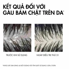 Vichy Dầu Gội giảm gàu ngứa Dercos Anti- Pelliculaire Sensitive 200ml 