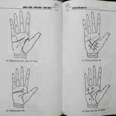 Bí Ẩn Trên Bàn Tay