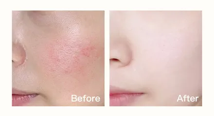 Máy Đẩy Tinh Chất & Nâng Cơ Massage Mặt HIH