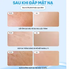 [KOREAN] MẶT NẠ RAU MÁ EXOCICA 28G/MIẾNG – EXOCICA MASK, LÀM DỊU, CẤP ẨM, GIÚP DA MỀM MỊN, PHÙ HỢP DA YẾU VÀ DA NHẠY CẢM