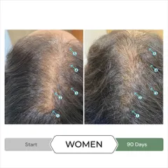 Bộ đôi gội xả Revita 8ml - Kích thích mọc tóc, ngăn ngừa tóc sơ yếu, chăm sóc da đầu khỏe mạnh, không chứa sulfate và paraben.