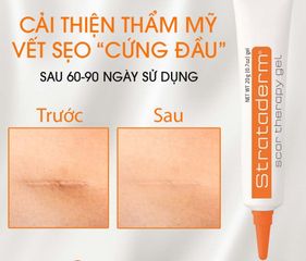 Kem Hỗ Trợ Cải Thiện Sẹo Lồi Strataderm Gel Thụy Sĩ - Hiệu Quả Cho Sẹo Lâu Năm Cho Người Lớn Và Trẻ Em