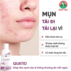 (Hàng chính hãng) Sữa Rửa Mặt Quatid 120ml - Hỗ Trợ Làm Sạch Mụn, Giảm Dầu Cho Da