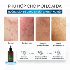 (Hàng nhập khẩu) Dung Dịch Triangle Peel PA Ahohwa 50ml - Dành Cho Da Khô, Kém Săn Chắc, Sạm Màu