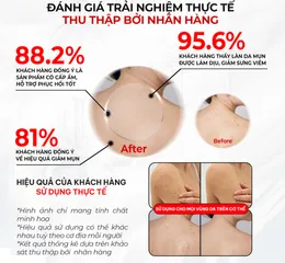 (Hàng nhập khẩu) Xịt Hỗ Trợ Cải Thiện Mụn Lưng Angels Liquid Glutathione Spot Care Body Mist 150ml