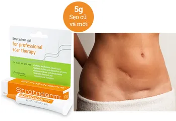 Kem Hỗ Trợ Cải Thiện Sẹo Lồi Strataderm Gel Thụy Sĩ - Hiệu Quả Cho Sẹo Lâu Năm Cho Người Lớn Và Trẻ Em
