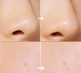 Nước hoa hồng Kiehl's Calendula Herbal Extract Alcohol-Free 250ml - Toner Duy Trì Cân Bằng Da Dầu, Hỗ Trợ Giảm Mụn, Dịu Nhẹ, Thiên Nhiên
