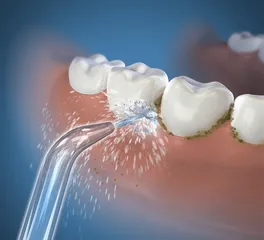 Bộ 2 Đầu Tăm Nước Thay Thế Waterpik JT-100E - Giải Pháp Làm Sạch Răng Miệng Hiệu Quả, Thích Hợp Cho Trẻ Em và Người Lớn