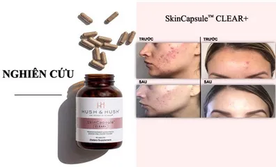 Viên Uống Hush & Hush Skin Capsule Clear+ Giảm Mụn, Hỗ Trợ Da Sáng Khỏe 60 Viên - Sản Phẩm Chăm Sóc Da Từ Thiên Nhiên