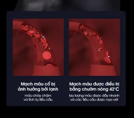 Máy Massage Cổ KASJ A1 Công Nghệ Đức - Giảm Đau Mỏi Cổ Vai, Thư Giãn Hiệu Quả, Thiết Kế Sang Trọng, Điều Khiển Từ Xa