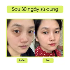 Kem Mắt Peiland Giảm Quầng Thâm Gấu Trúc - Dưỡng Ẩm, Chống Lão Hoá, Hỗ Trợ Trẻ Hoá Da Mắt 15g