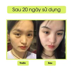 Kem Mắt Peiland Giảm Quầng Thâm Gấu Trúc - Dưỡng Ẩm, Chống Lão Hoá, Hỗ Trợ Trẻ Hoá Da Mắt 15g