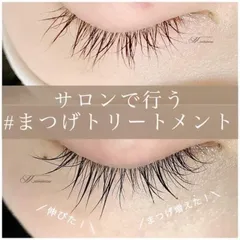 Tinh Chất Dưỡng Dài và Dày Mi Matsuge Omoi Nhật Bản 6ml - Hỗ Trợ Kích Thích Mọc Mi Khỏe, Giảm Gãy Rụng, Dưỡng Mi Mềm Mượt
